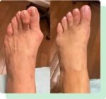 Best Doctor For Flat Feet New Brunswick